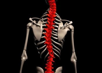 AI Smartphone App Can Be Beneficial for Managing Adolescent Idiopathic Scoliosis