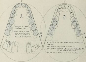 Deep Learning Algorithm Can Detect Occlusal Caries From Photographs